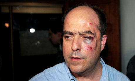 Julio Borges, an opposition member of Venezuela's National Assembly, shows his bruised face