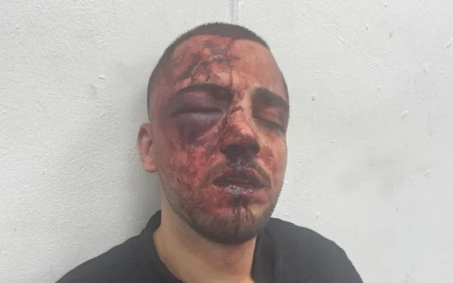ВИЗНЕМИРУВАЧКО ВИДЕО: Израелски полицајци претепаа арапски обвинител
